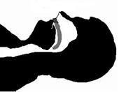 apnee sommeil centrale